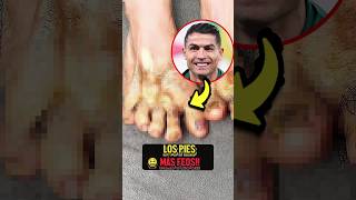 Los Pies Más Feos Del Fútbol El Número Uno Te Dejará En Shock