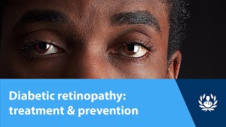 Diabetic Retinopathy Treatment & Prevention