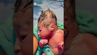 Nicu Journey My Babys Head Shape & Healthy Growth