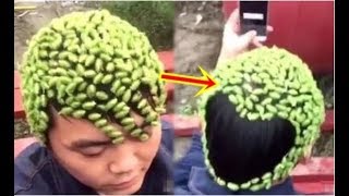 Hàng trăm con sâu róm lúc nhúc trên đầu thanh niên, nhờ người gỡ từng con mới choáng vì cảnh tượng