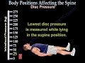 Body Positions Affecting the spine and discs - Everything You Need To Know - Nabil Ebraheim, MD