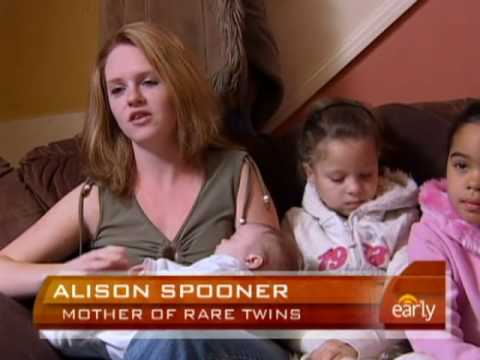 Black And White Twins. Black And White Twins Black And White Twins. Black And White Twins