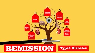 Know How - Remission Of Type 2 Diabetes Treatment T2Dm Dr. Tulip Jp Nagar