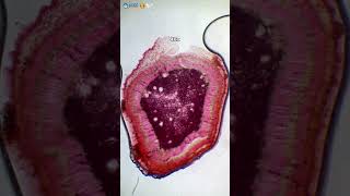 Under Microscope Episode 4 Cordyline Fruticosa Stem
