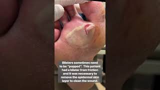 This Needed Popped