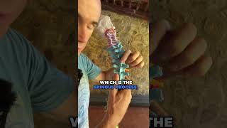 Scoliosis Rotation