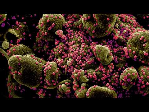FOTOS ðŸ˜· Captan Coronavirus Atacando Células Humanas | Primer plano del SARS-CoV-2