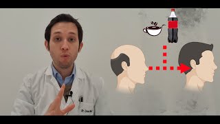 Doctor te explica si la cafeína ayuda a la calvicie
