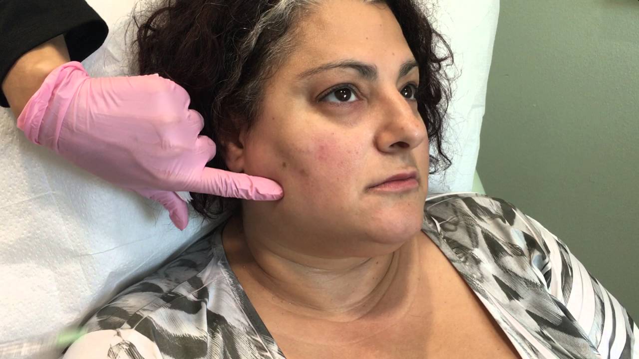 Botox Cosmetic Channel