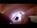 Asmr Ear Cleaning Peel Off Suzevi Asmr Ear Cleaning Peel Off Suzevi