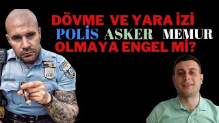 Dövme Ve Kesi̇k İzi̇ Asker Ve Poli̇s Olmaya Engel Mi̇