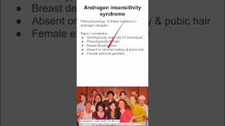 Androgen Insensitivity Syndrome