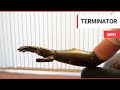 'Terminator' arm is world's most advanced prosthetic limb