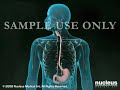 Endoscopy