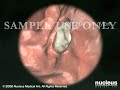 Endoscopy