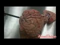 Cerebrum