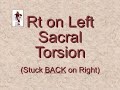 Sacral
