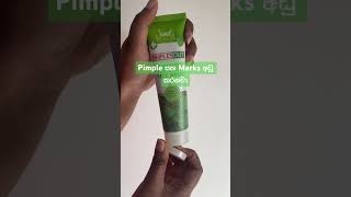 ඔයට තයනනත ඉකමනට Pimples එන Skin එකක ද?