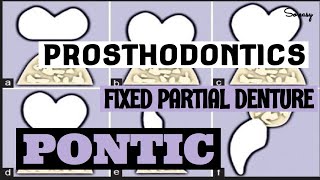 Pontic Ii Component Of Fixed Partial Denture Ii Prosthodontics