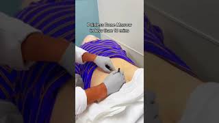 How Are Bone Marrow Biopsies Done?