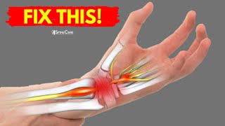 How To Fix Wrist Pain For Good