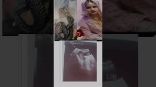 A Women Gave Birth To A Snake.......allahu Akber