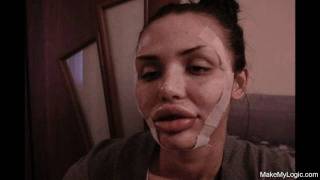 Another Super Pretty Victim Of Plastic Surgeons