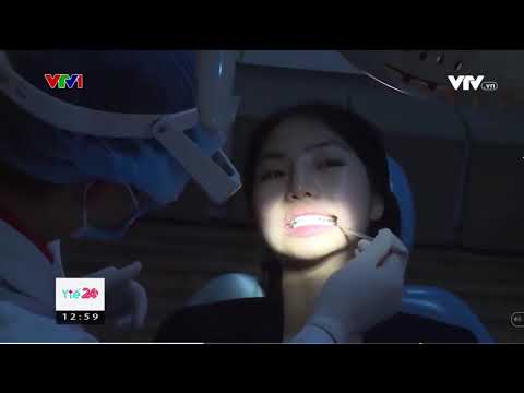 CẨN TRỌNG KHI "LÀM ĐẸP ĐÓN TẾT" BẰNG MIẾNG DÁN TRẮNG RĂNG