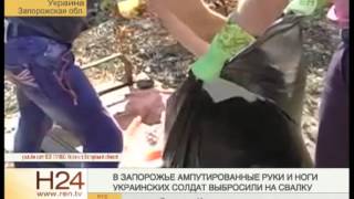 На Украине нашли тонну ампутированных конечностей