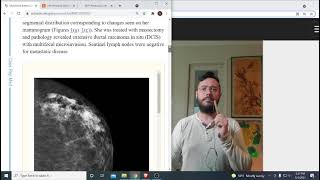 Women's Health, EMF exposure and breast cancer