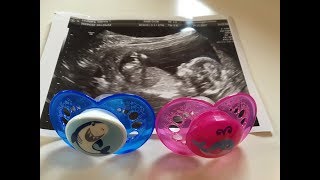 MY BABY'S GENDER REVEAL!ππ MY BABY'S GENDER REVEAL!ππ