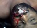 A Kugan Meninggal Dalam Tahanan Polis images A Kugan Meninggal Dalam Tahanan Polis