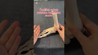 Ayak Ağrısı