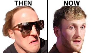 Logan Pauls Shocking Hair Regrowth Hair Surgeon Reacts