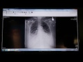Fuji Highlights DR X-ray Advances at RSNA 2014