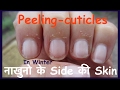 How To Get Rid Of Peeling Skin On Fingertips In Hindi peeling cuticle | नाखुनो के Side की Skin