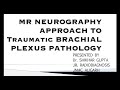 22nd MRI Teaching Course | Dr Shikhar Gupta | MR Neurography for Brachial Plexus Pathologies