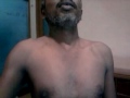 clavicular