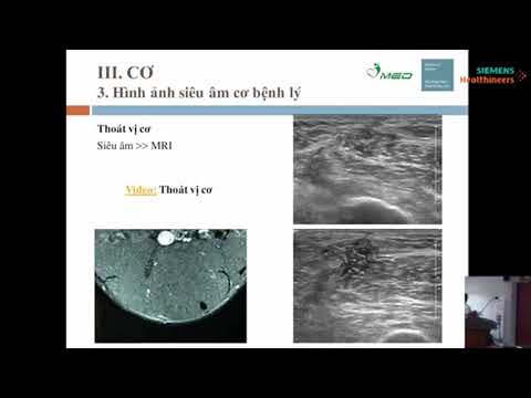 LỚP HUẤN LUYỆN SIÊU ÂM CƠ XƯƠNG KHỚP VÀ SIÊU ÂM HƯỚNG DẪN ĐIỀU TRỊ CAN THIỆP KHỚP