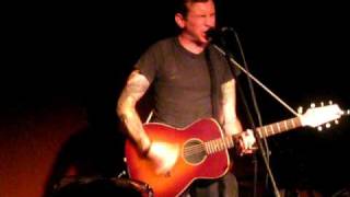 Watch Tom Gabel Amputations video