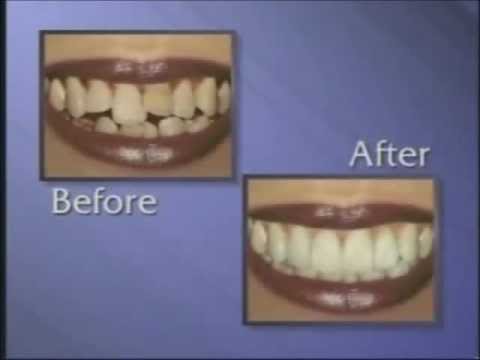 Dentist Bronx New York (NYC)