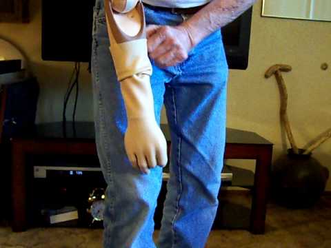 This is a Demonstration on how to use a Hanger Prosthetic arm. This is a Demonstration on how to use a Hanger Prosthetic arm.