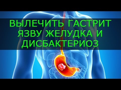 Гастрит желудок как лечить в домашних условиях Гастрит желудок как лечить в домашних условиях