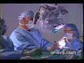 Brain Tumor Surgery