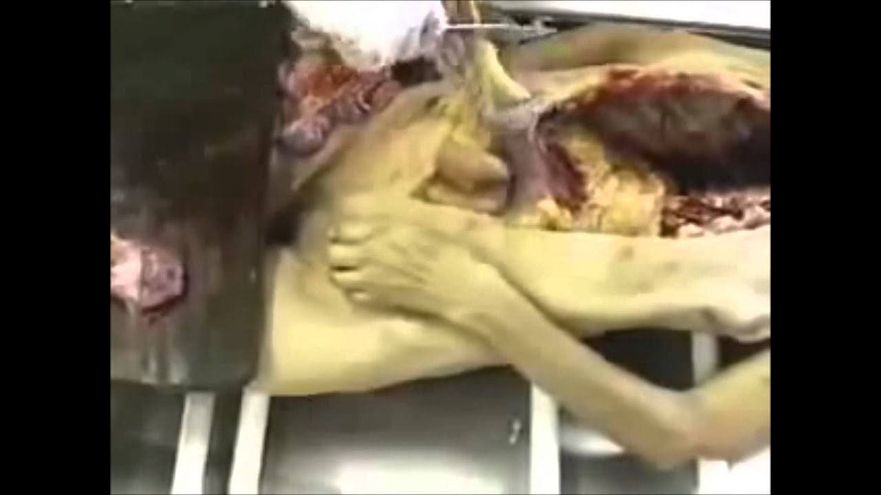 WWW YOUTUBE COM VIDEO DE AUTOPSIA www youtube com video de autopsia: