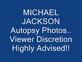 Michael Jackson Autopsy Photos viewer discretion!!!!