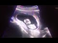 Juniors first ultrasound