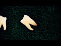 dental fetish