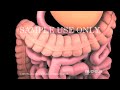 Medical Animation: Colon Resection