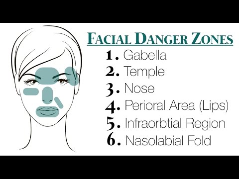 Avoiding danger facial facial in injury nerve plastic surgery zone